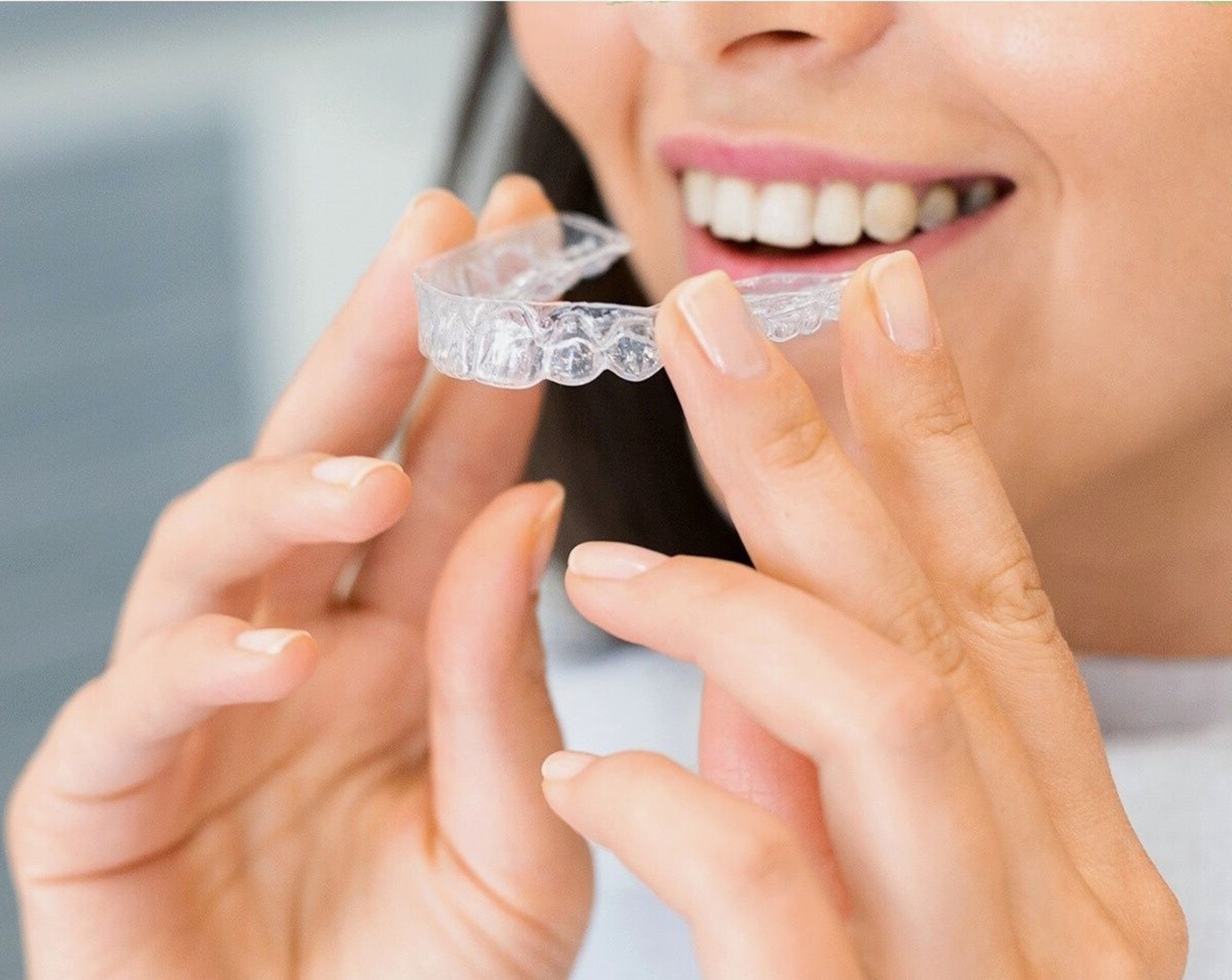 Clear Aligners - Image