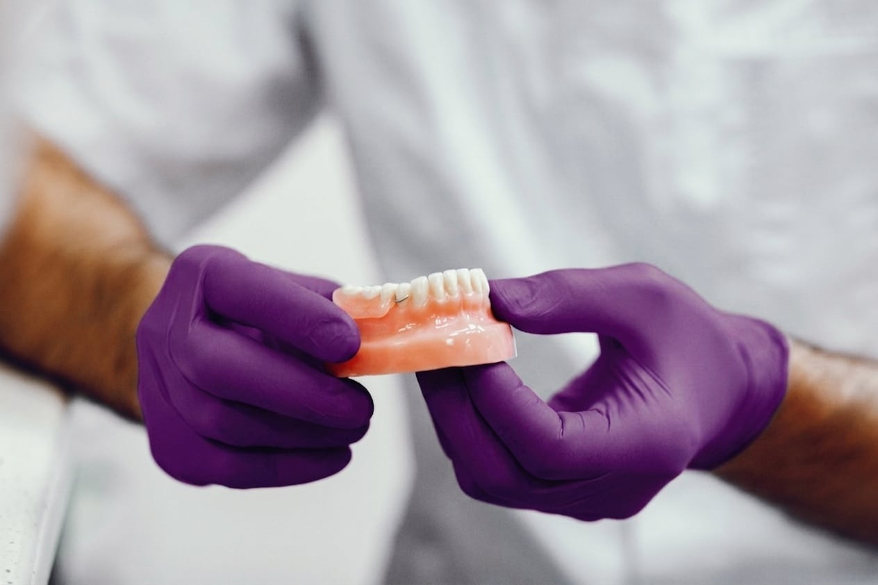 Dental Bridge-Image