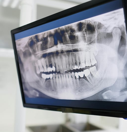 Digital X-Rays