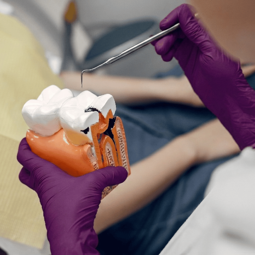 Root Canal-Image